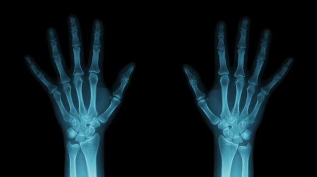 Wilhelm Roentgen discovered X-rays