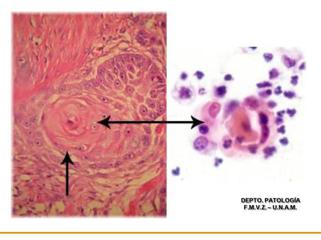 La Patología celular empieza en Alemania
