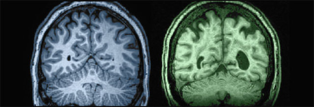 Intelligence over time