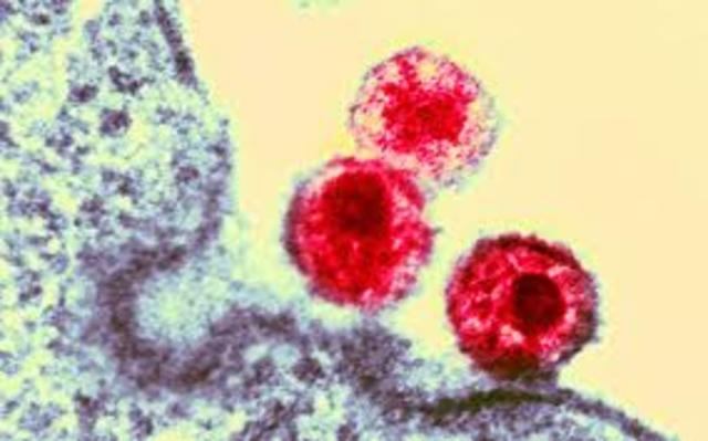 Discovery of HIV