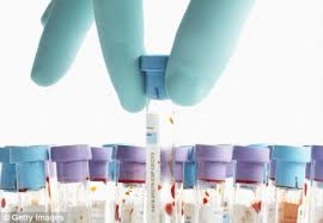 FDA licenses the first nucleic acid test intended for screening of blood and plasma donors.