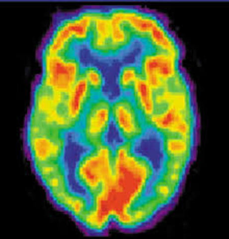 PET scans