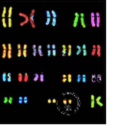 Chromosome 22