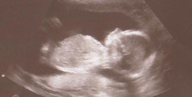 Faye finds out she's PREGO with a miracle Divette