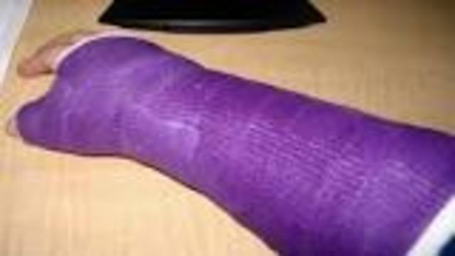 I broke my hand/wrist again.