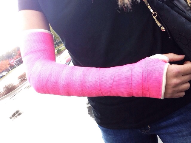 I broke my arm