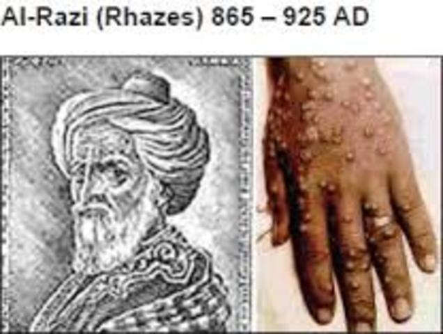 Rhazes discovered difference between small pox and measles