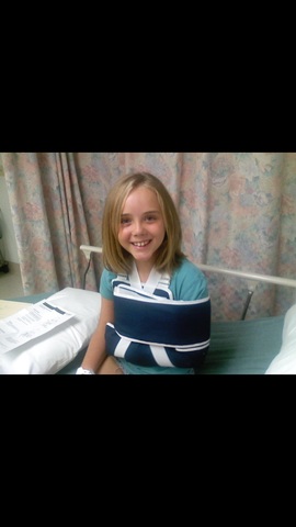 When I broke my arm