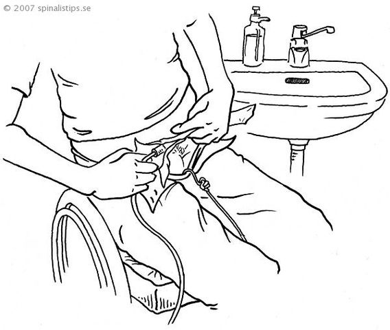 Irving Independent Sch. Dist. v. Amber Tatro 468 U.S. 883