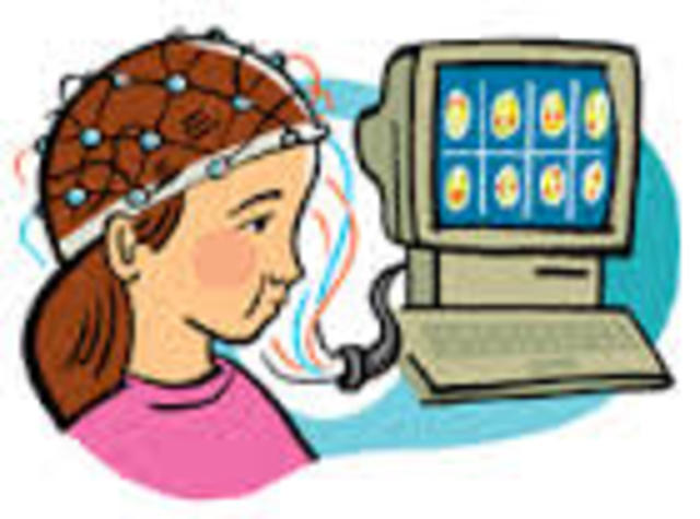 Electroencephalogram