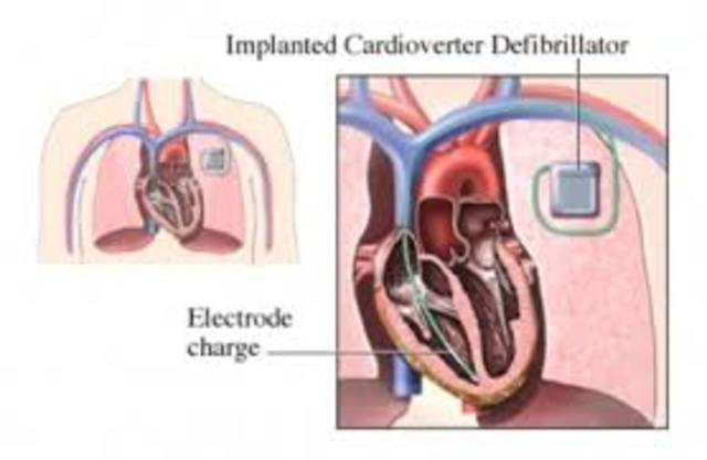 Cardiac Defibrillation