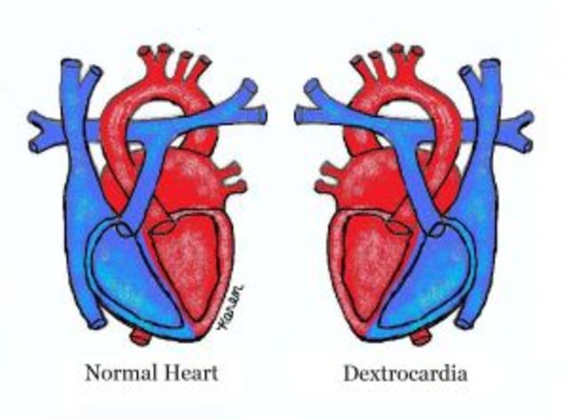 Life is full of Surprises