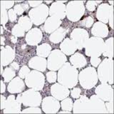 first isolated antibodies