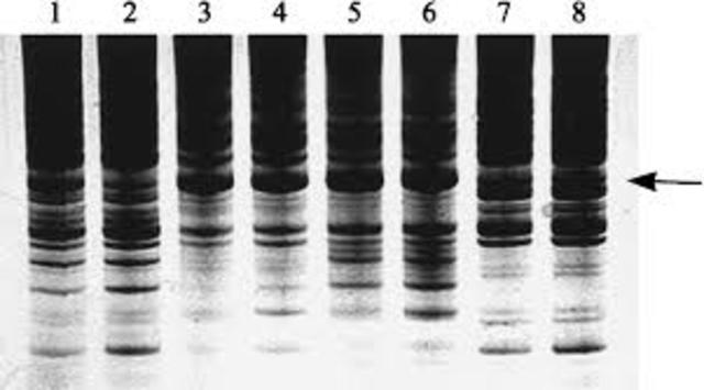 Start of DNA profilin