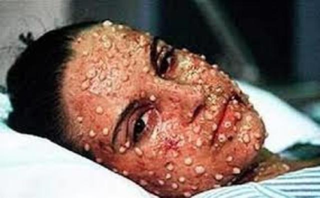 bubonic plague hits san fansisco