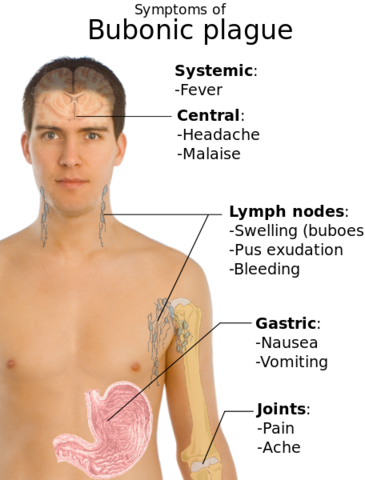 Bubonic plaque hits San Francisco