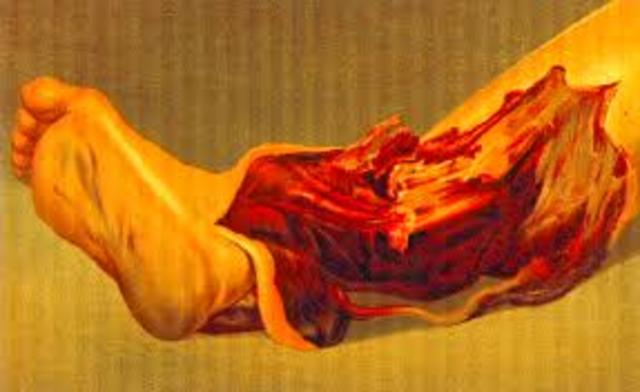 pioneered the treatment of gunshot wounds