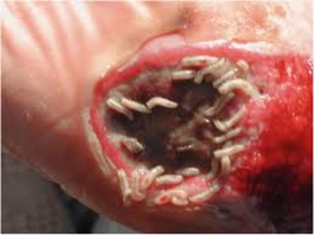 Steve Thomas used sterile maggots to clean a wound