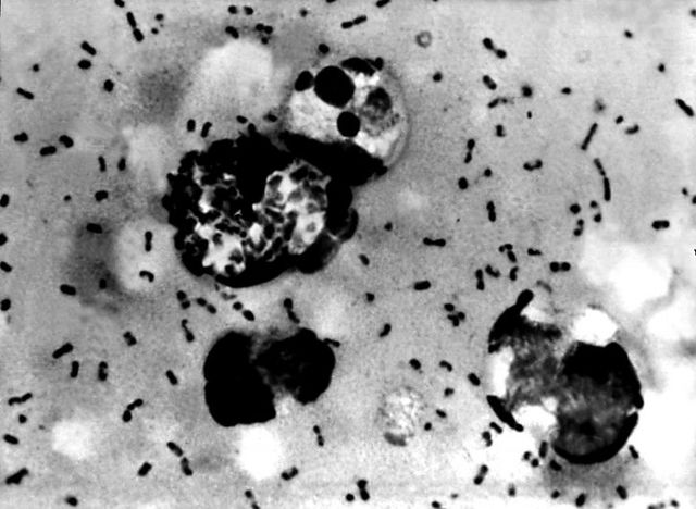 Bubonic Plague appeared in istanbul.