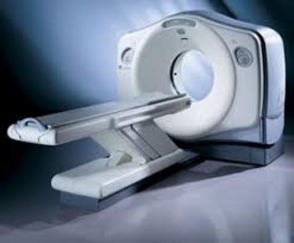 CAT scan was invented.