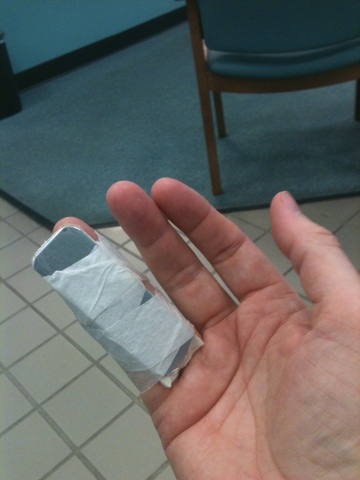 Broke my pinky