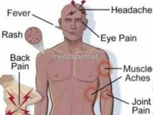 Outbreak of typhoid fever