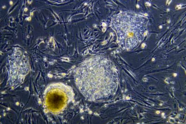 Stem Cells Discovered