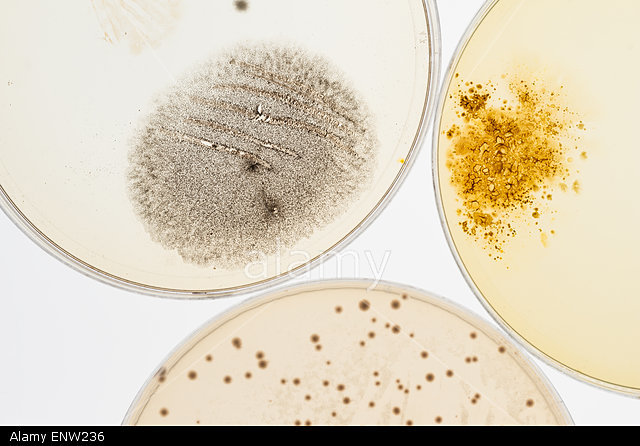 Agar Used to Grow Microbial Samples