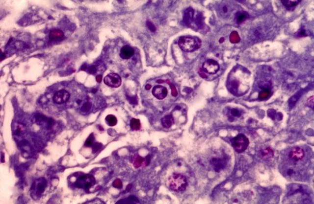 Scientists discover how to use human skin cells to create embryonic stem cells.