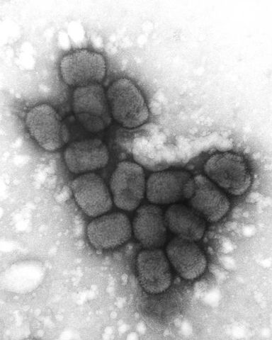 British country doctor, Edward Jenner developed the smallpox vaccine.