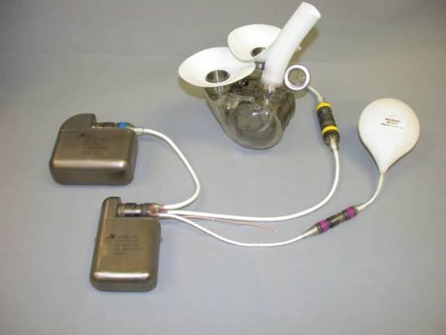 Second Patient Recieve the AbioCor Transplant