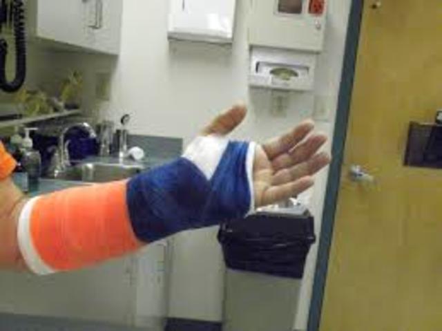I broke my right wrist.