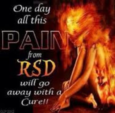 i got (CRPS)