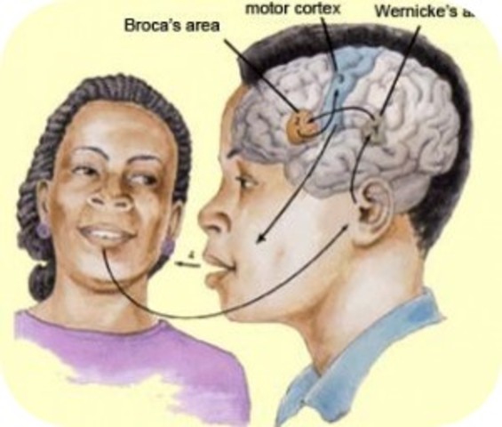 Area de Broca