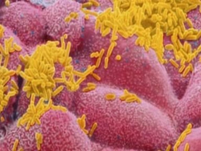 Haemophilus influenzae