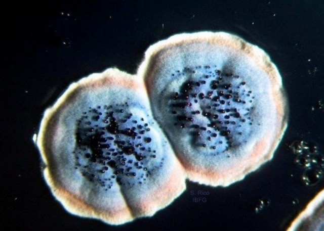 Streptomyces coelicolor