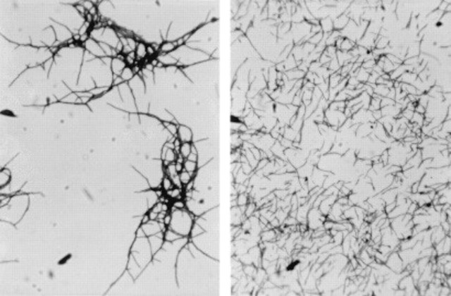 Saccharopolyspora erythraea