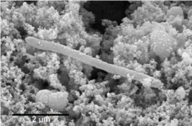 Desulforudis audaxviator