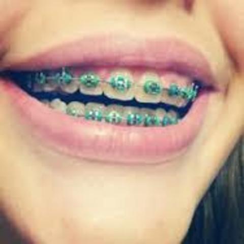 Braces