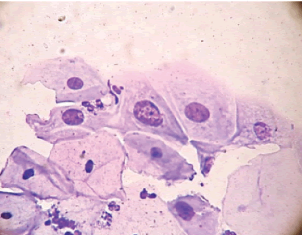 Coloración de Giemsa