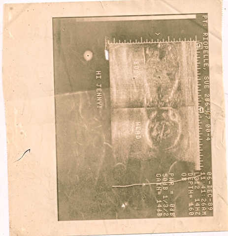 Biosocial: 5 month fetus