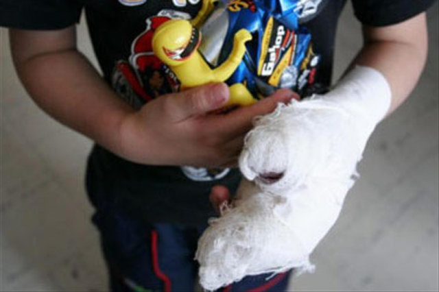 MI PRIMERA QUEMADA CON POLVORA