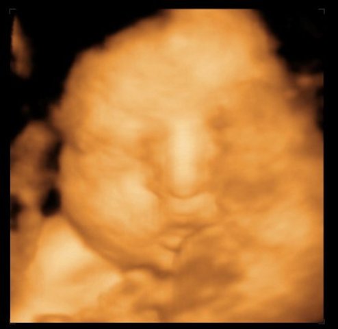 En la barrigita cuando fuí concebida