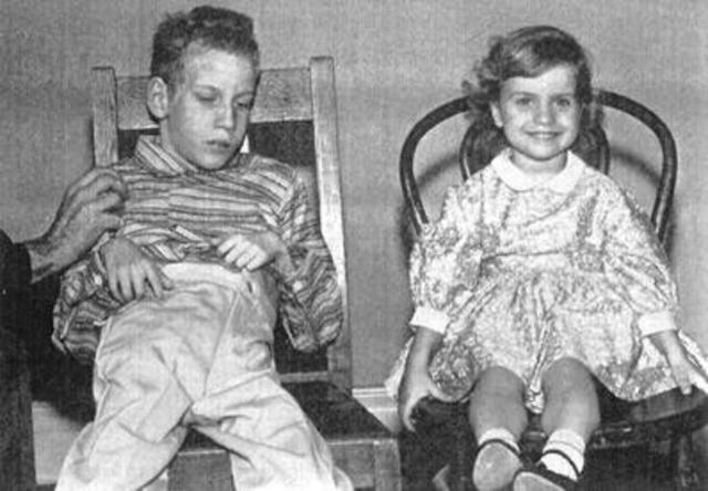 PKU (phenylketonuria)