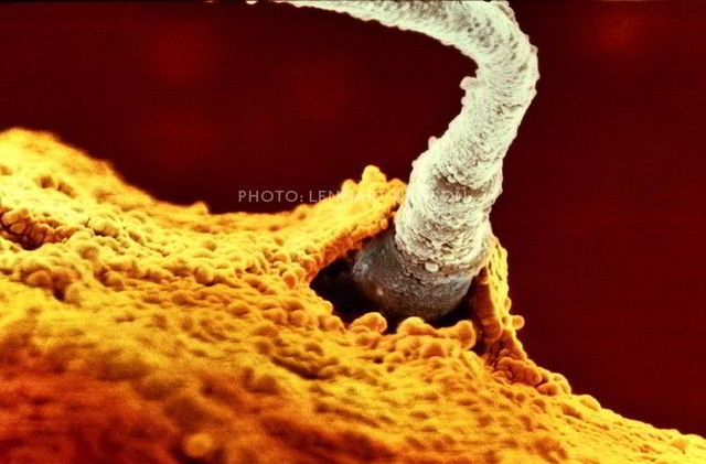 Etapa de la Concepción