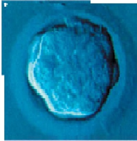 Día 4. Tras la fecundación