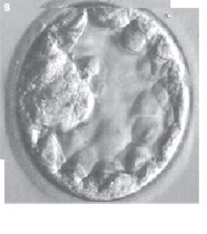 Día 5. Tras la fecundación