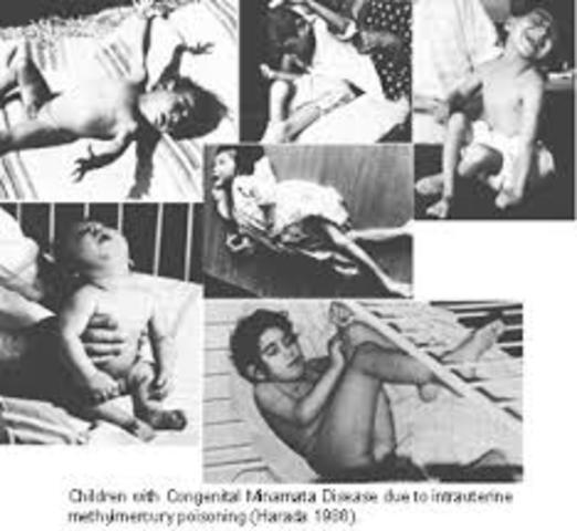 Minamata Disease