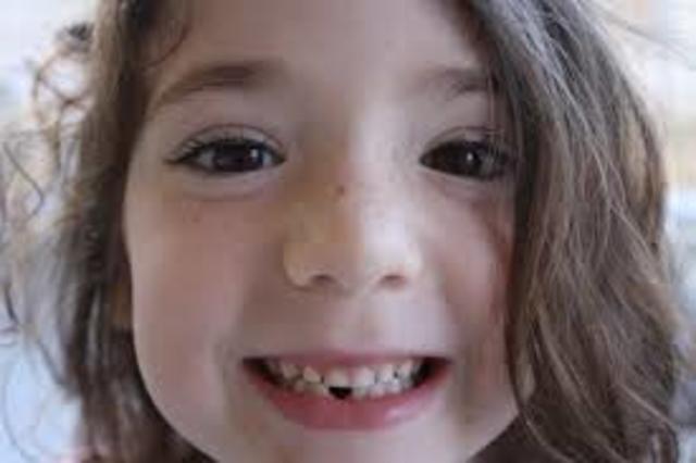 Lost my first tooth