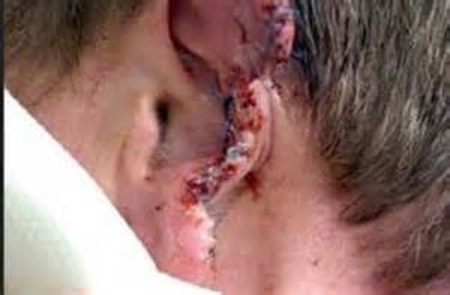 Misha gets ear shot off